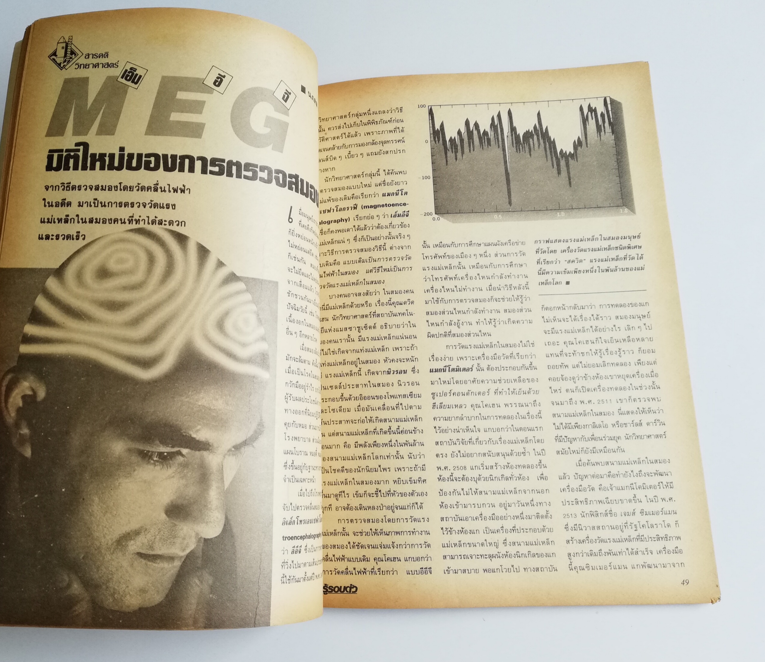 นิตยสารเก่า เดือนเมษายน 2532 "รู้รอบตัว ปีที่4 ฉบับที่ 39" :-การแพทย์ในศตวรรษที่21, หมอ เอทีเอ็ม วินิจฉัยโรคขั้นต้นแบบด่วนทันใจ ไม่ต้องใช้หมอคน, อวัยวะมนุษย์ยุคไฮเทค, อวัยวะเทียมที่ใช้แทนของจริงได้ทั่วร่างกายทั้งเครื่องในและเครื่องนอก, MEG มิติใ