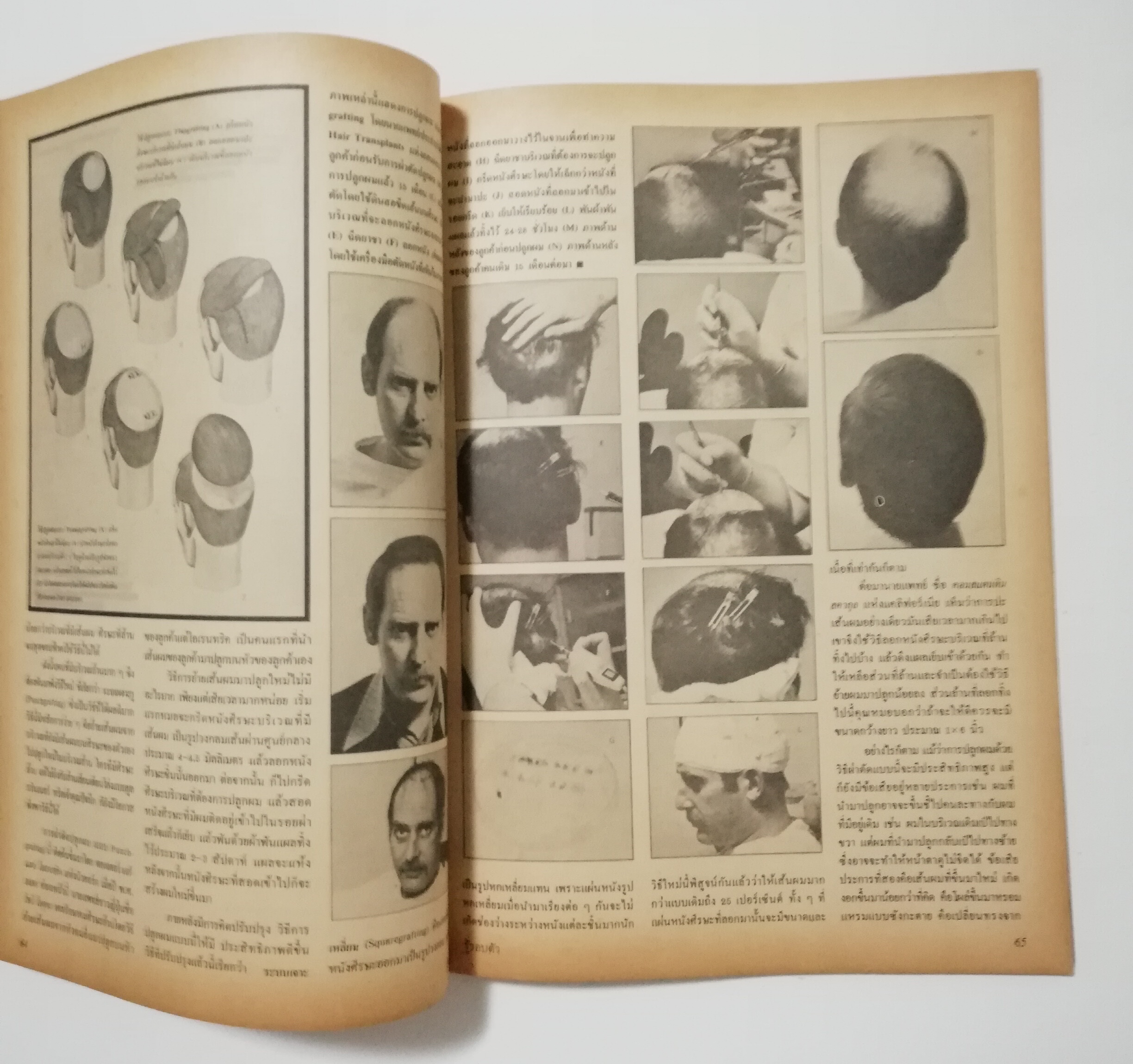 นิตยสารเก่า พฤษภาคม 2530 รางวัลชมเชยสื่อมวลชนดีเด่นเพื่อเยาวชนประเภทวารสารเฉพาะ ประจำปี 2528-2529 "รู้รอบตัว ฉบับที่ 17" วารสารเพื่อความรอบรู้สำหรับทุกคนในยุควิทยาศาสตร์ :-อะไหล่สมองผ่าตัดขจัดโรคล้าน,เตรียมตัวเพื่อรับศตวรรษหน้า,สลัดซากเก่าสู่วิ