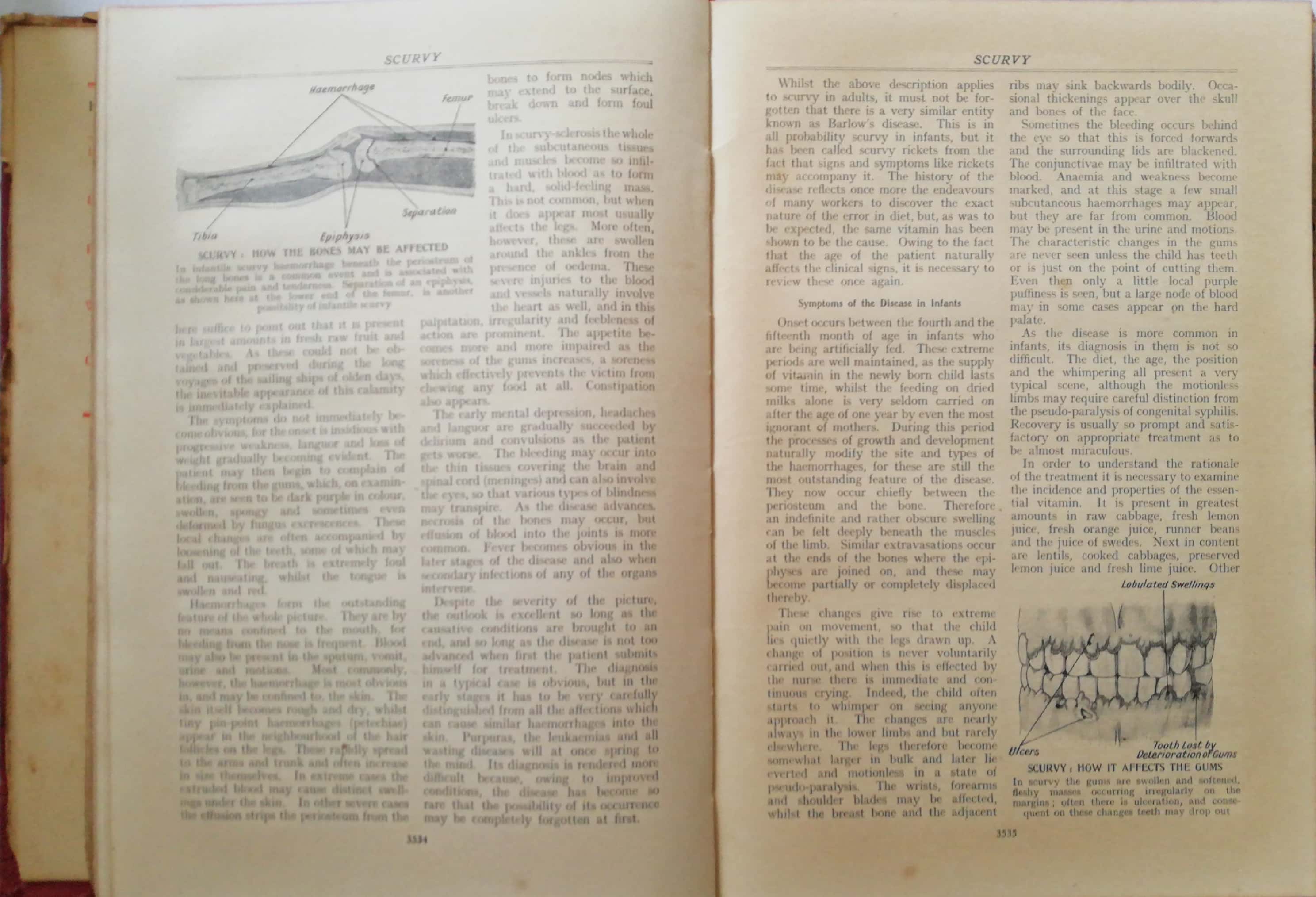 นิตยสารทางการแพทย์เก่า ฉบับภาษาอังกฤษ HARMSWORTH'S HOME DOCTOR& ENCYCLOPEDIA OF GOOD HEALTH**หนังสือเก่ามีตำหนิตามภาพ